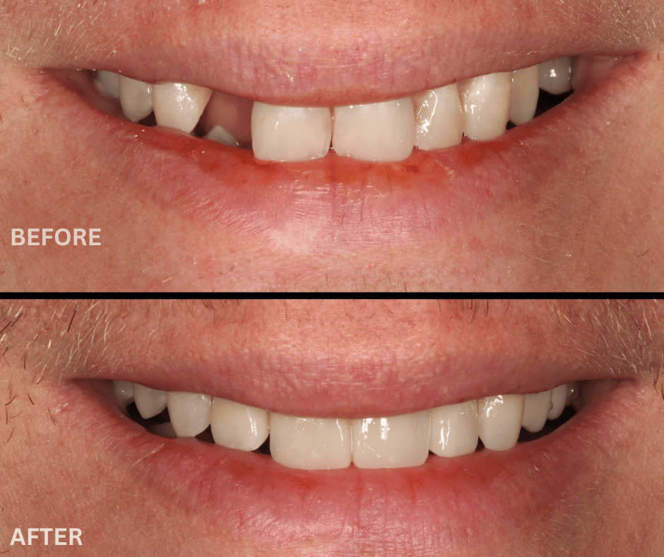 24.png