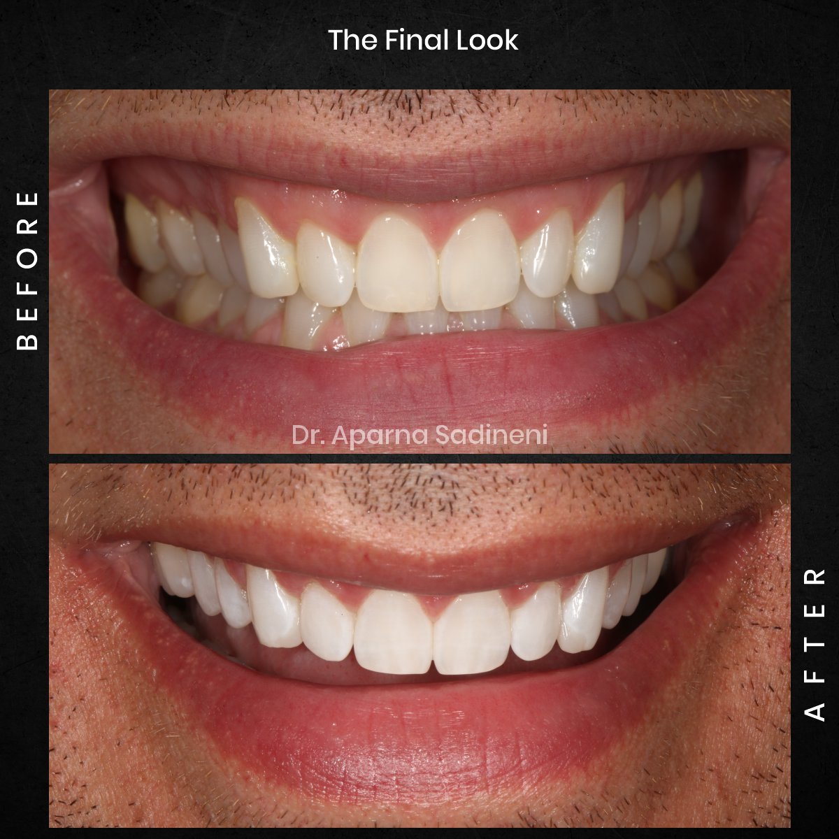 DMD-OCT-GRID-4-BA-TEETH-CAROUSEL-MICHAEL_3.jpg