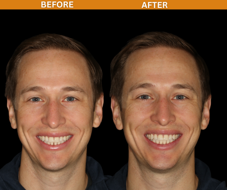FACE-768x644-1.png