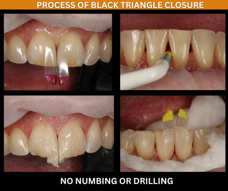 PROCESS-768x644-1.png